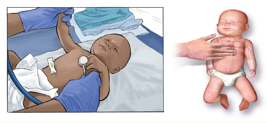 Course S4 Maternal Child Topic UNIT 6IMMEDIATE CARE OF A NEWBORN